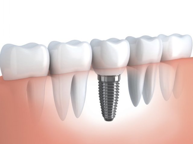 Dentplus Dental Clinic